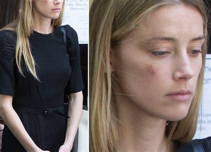Amber Heard Lying? She’s ‘Shocked’ By Accusations About Faking Johnny Depp Abuse – Hollywood Life