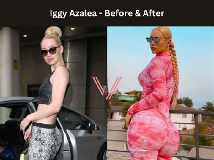 Iggy Azalea Celebrity Profile – Hollywood Life